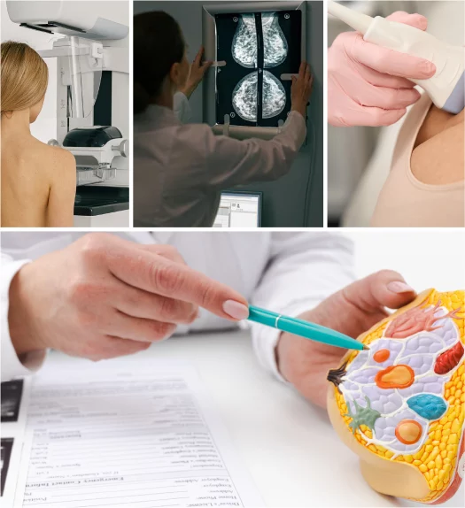 Imagen destacada de Curso Imágenes Mamarias: Basadas en los Escenarios Clínicos más Habituales