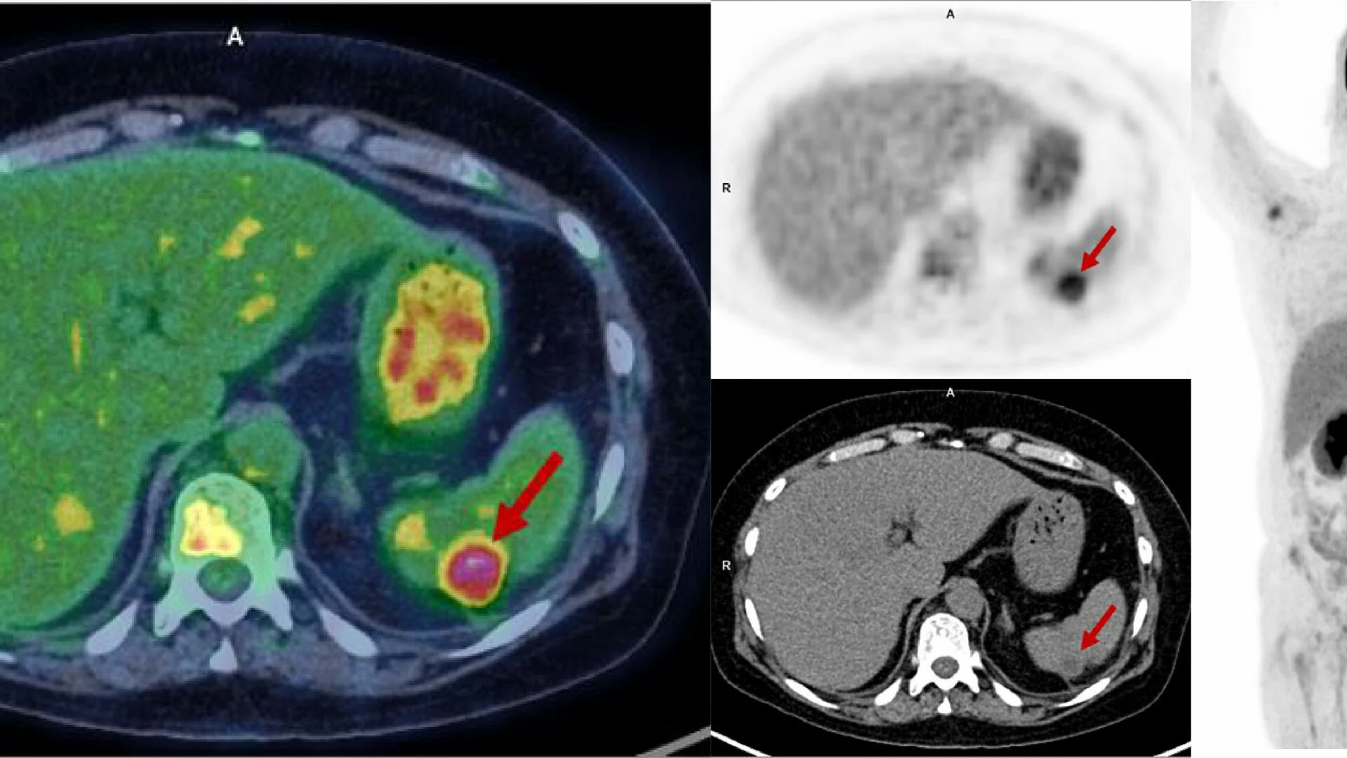 Imagen destacada de Diplomado en Aplicaciones Clínicas en PET-CT e Imágenes Moleculares