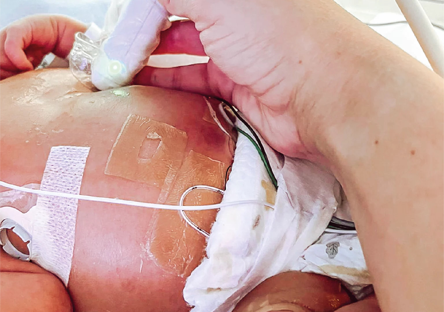Imagen destacada de Curso y Taller Ecografía Point of Care (POCUS) en el Paciente Crítico Neonatal