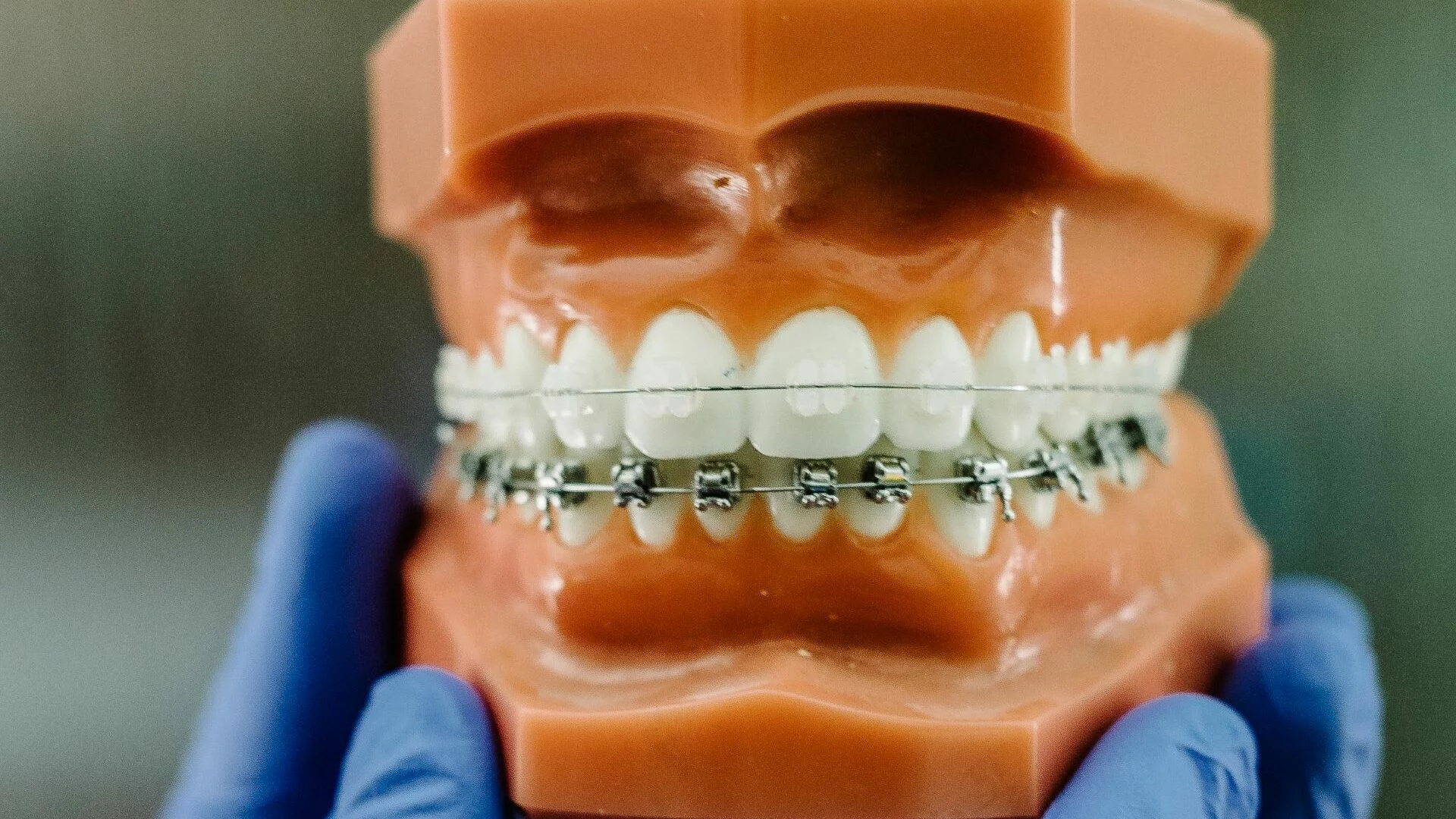Imagen destacada de Postítulo de Especialidad Odontológica en Ortodoncia y Ortopedia Dentomaxilofacial