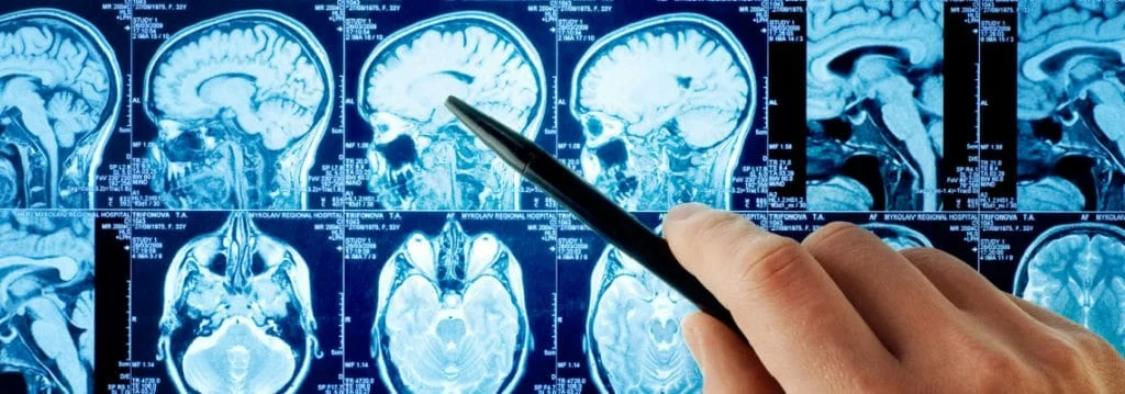 Imagen destacada de Postítulo de Especialidad Médica en Neurología Adultos