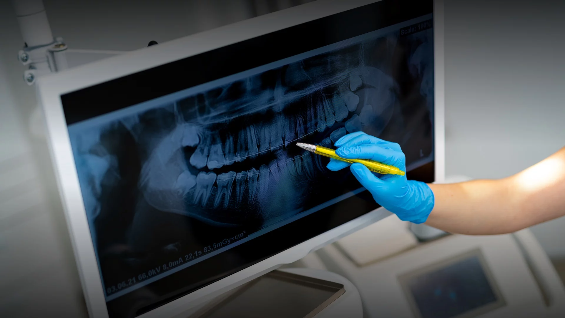 Imagen destacada de Pasantía clínica en Urgencia Bucomáxilofacial