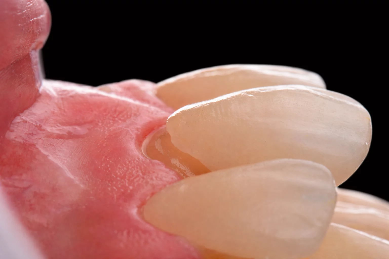 Imagen destacada de Jornada Toma de Decisiones Clínicas, Flujo Digital y Protocolos para Carillas Indirectas